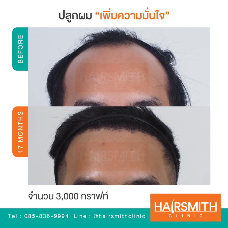 My Image 16